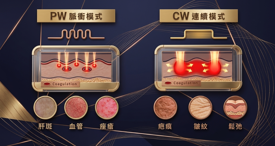 CW PW功效