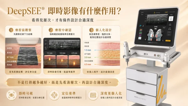 DeepSee 即時影像有什麽用