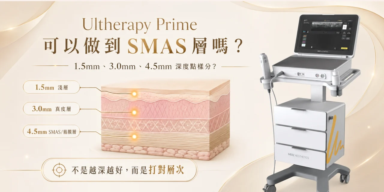 Ultherapy Prime 可以做到 SMAS 層嗎？1.5mm、3.0mm、4.5mm 深度點樣分？