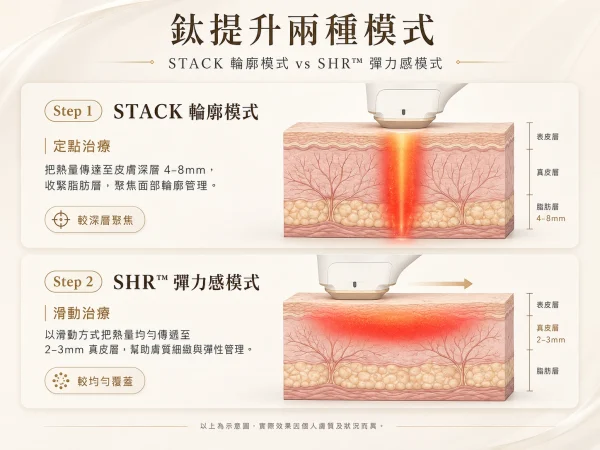 STACK_輪廓模式與_SHR™_彈力模式有什麼分別？