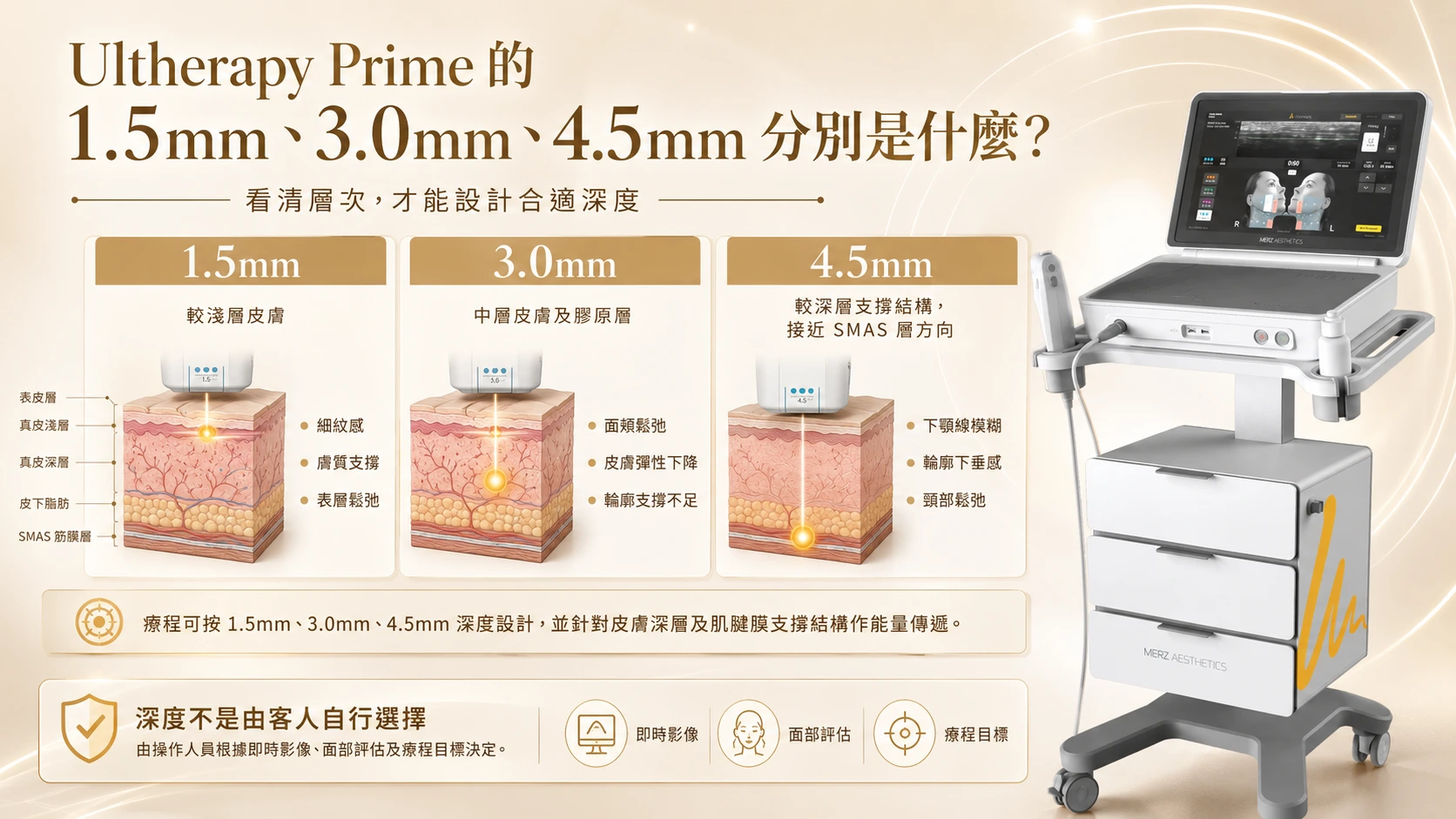 Ultherapy Prime 的 1.5mm、3.0mm、4.5mm 分別是什麼？