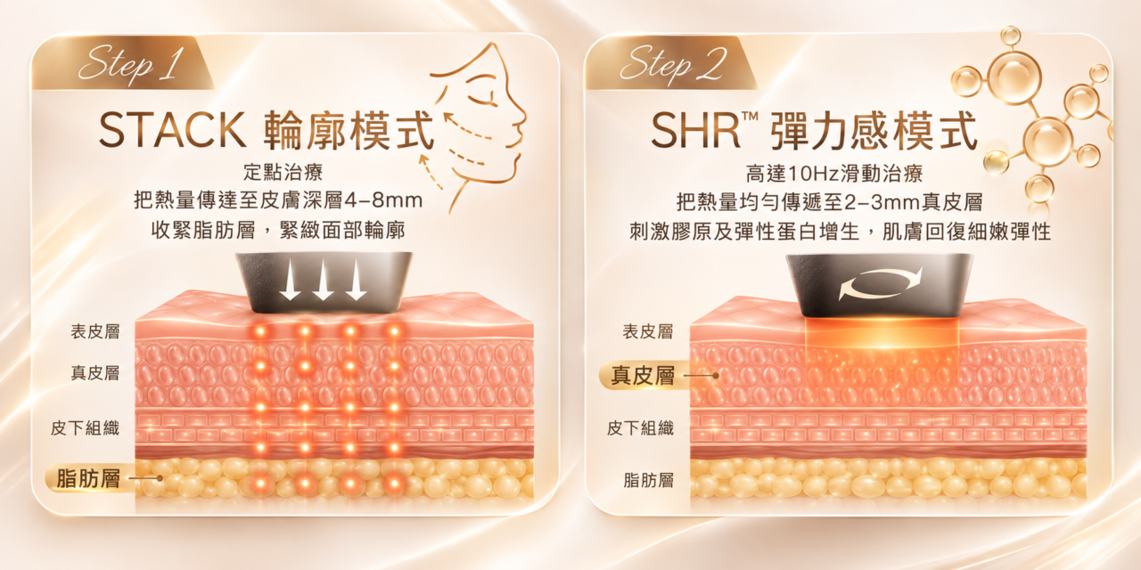 STACK 輪廓模式與 SHR™ 彈力模式