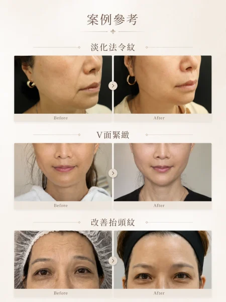 案例參考