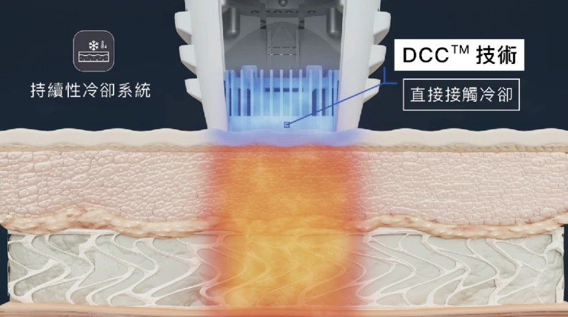 獨家專利冷卻技術 DCC™(直接接觸式冷卻)的獨家專利技術