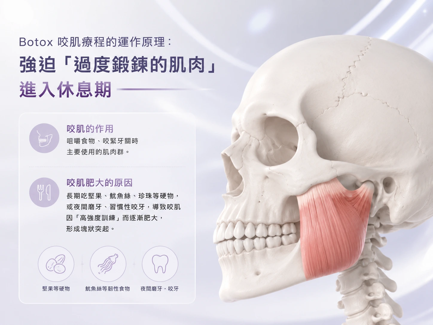Botox 咬肌療程的運作原理：強迫「過度鍛鍊的肌肉」進入休息期