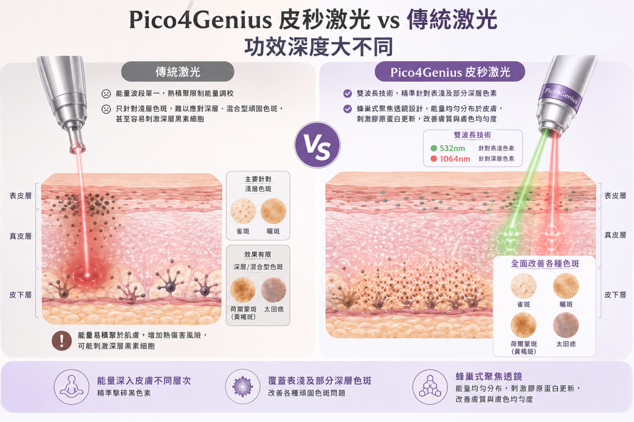 Pico4Genius皮秒激光與傳統激光去斑在功效深度的對比 Pico4Genius皮秒激光與傳統激光去斑在功效深度的對比