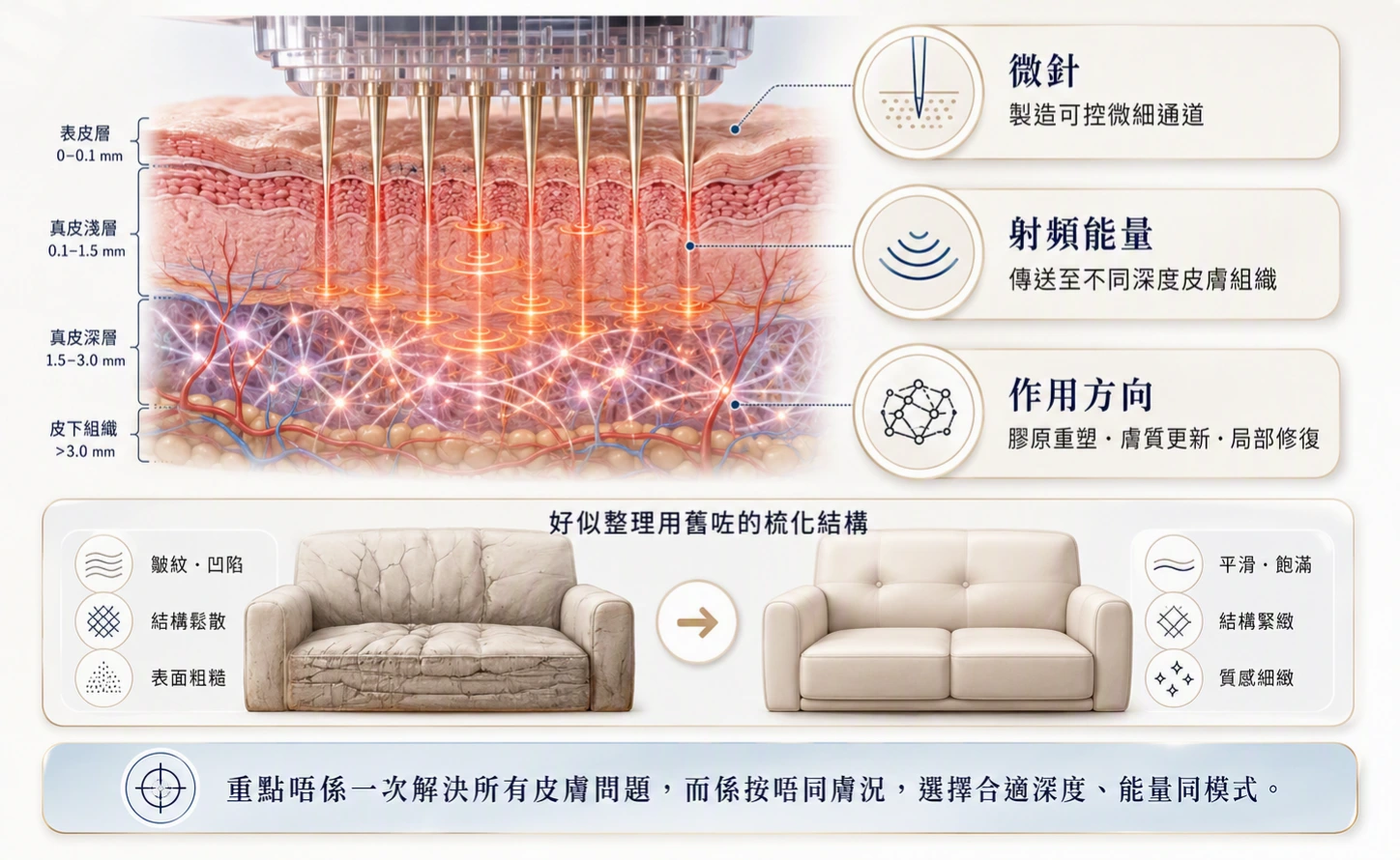 SYLFIRM_X_微針射頻係咩？ (1)