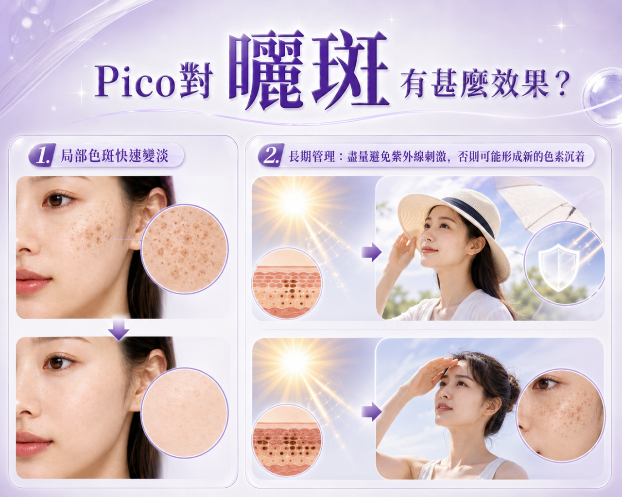Pico效果（曬斑）