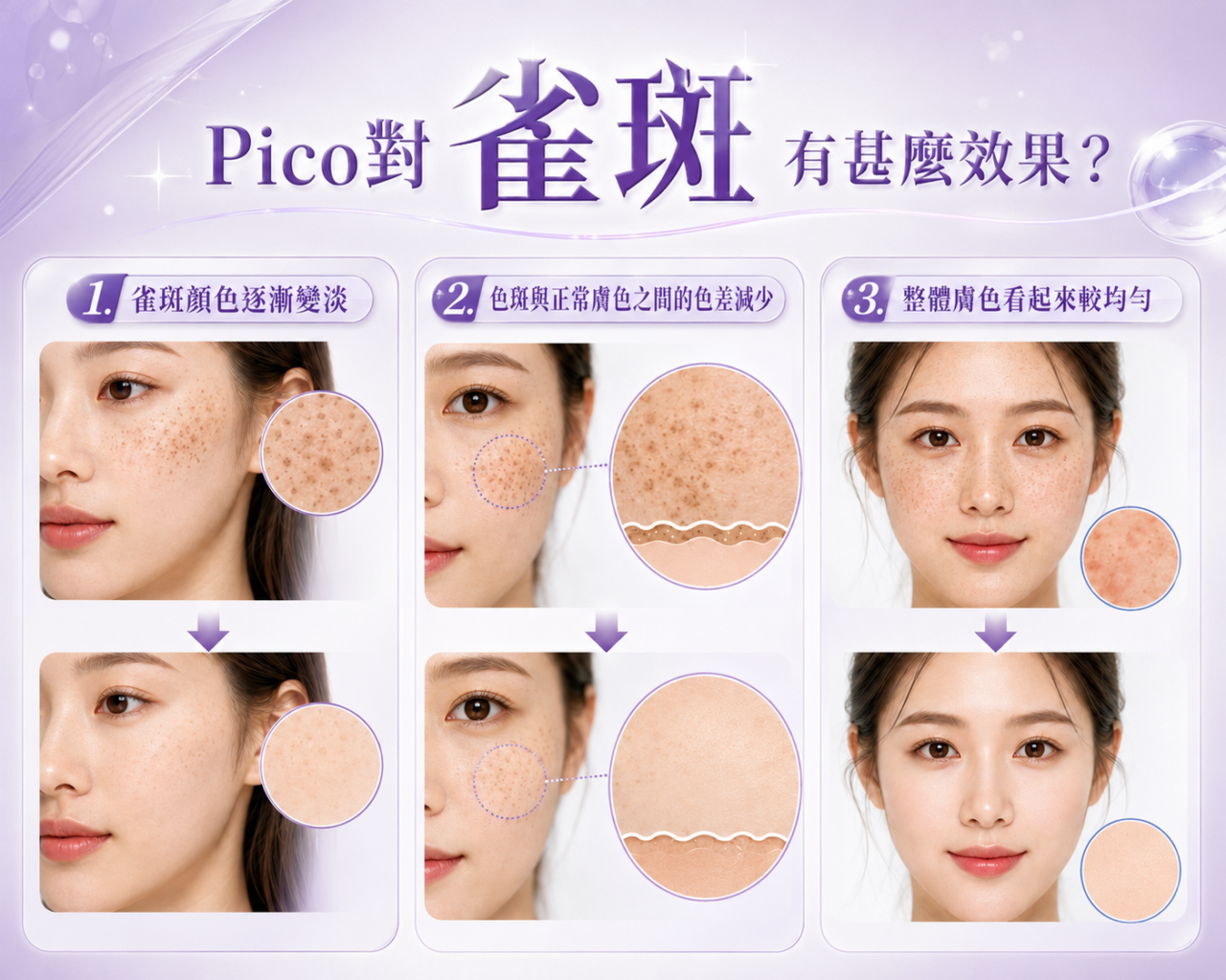 Pico效果（雀斑）