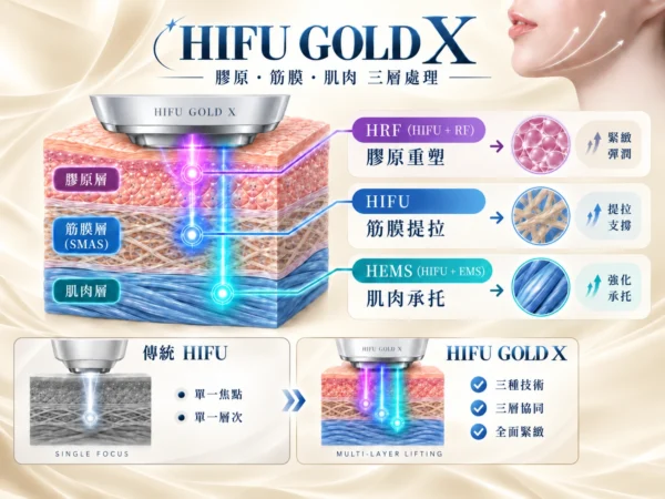 HIFU GOLD X：由「單一筋膜層」變成膠原、筋膜、肌肉三層處理 (2)
