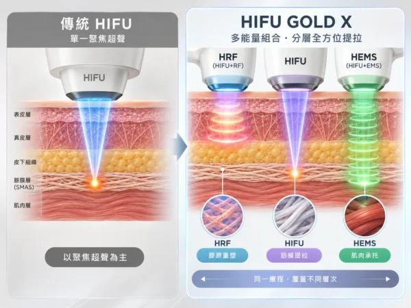 HIFU GOLD X：單一聚焦超聲 vs. 多能量組合