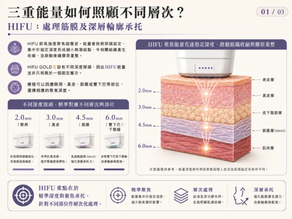 HIFU：處理筋膜及深層輪廓承托