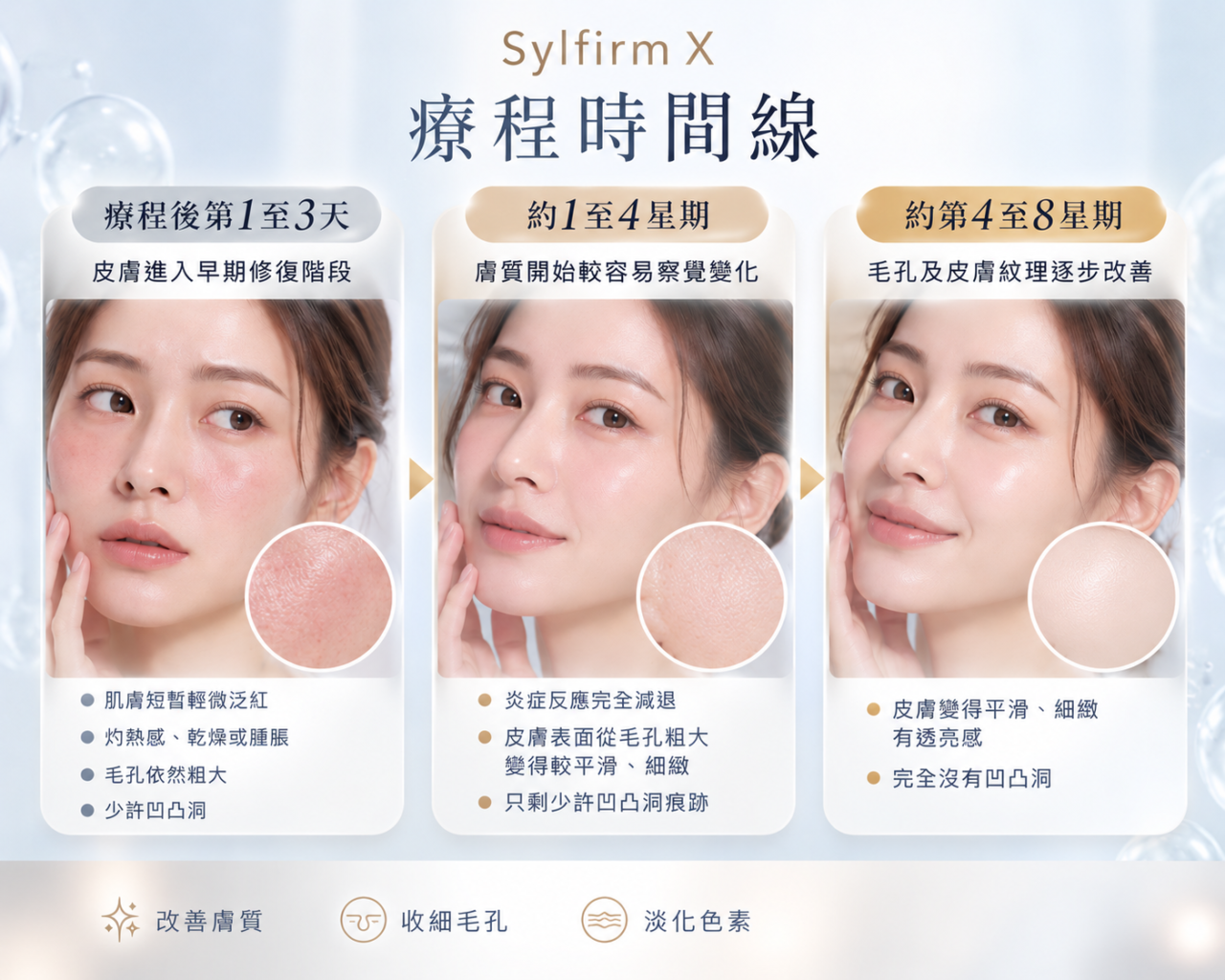 Sylfirm X一般需要做幾次？