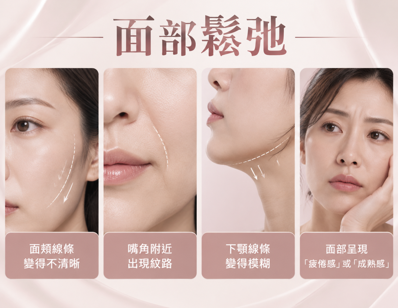 不只是皮膚變薄，而是支撐力下降
