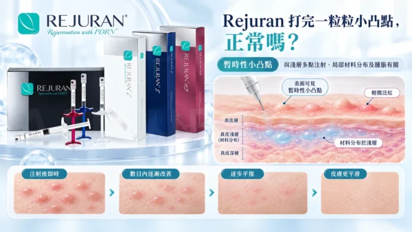 Rejuran注射後小凸點護理指南