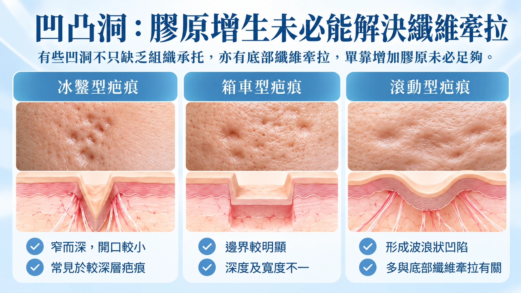 凹凸洞疤痕三類對照圖
