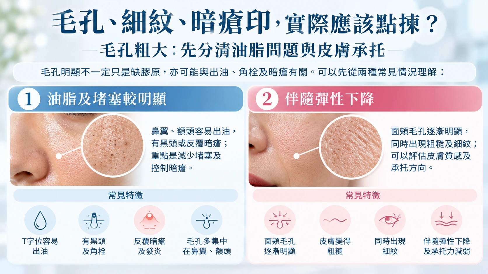 毛孔、細紋、暗瘡印，實際應該點揀？